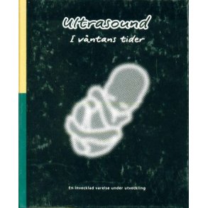 Ultrasound i vntans tider
